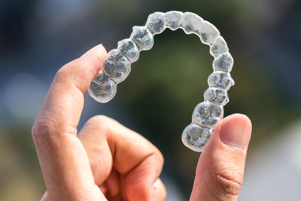 Invisalign-Invisible-Braces.jpg