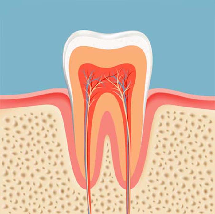 Root Canals in Las Vegas